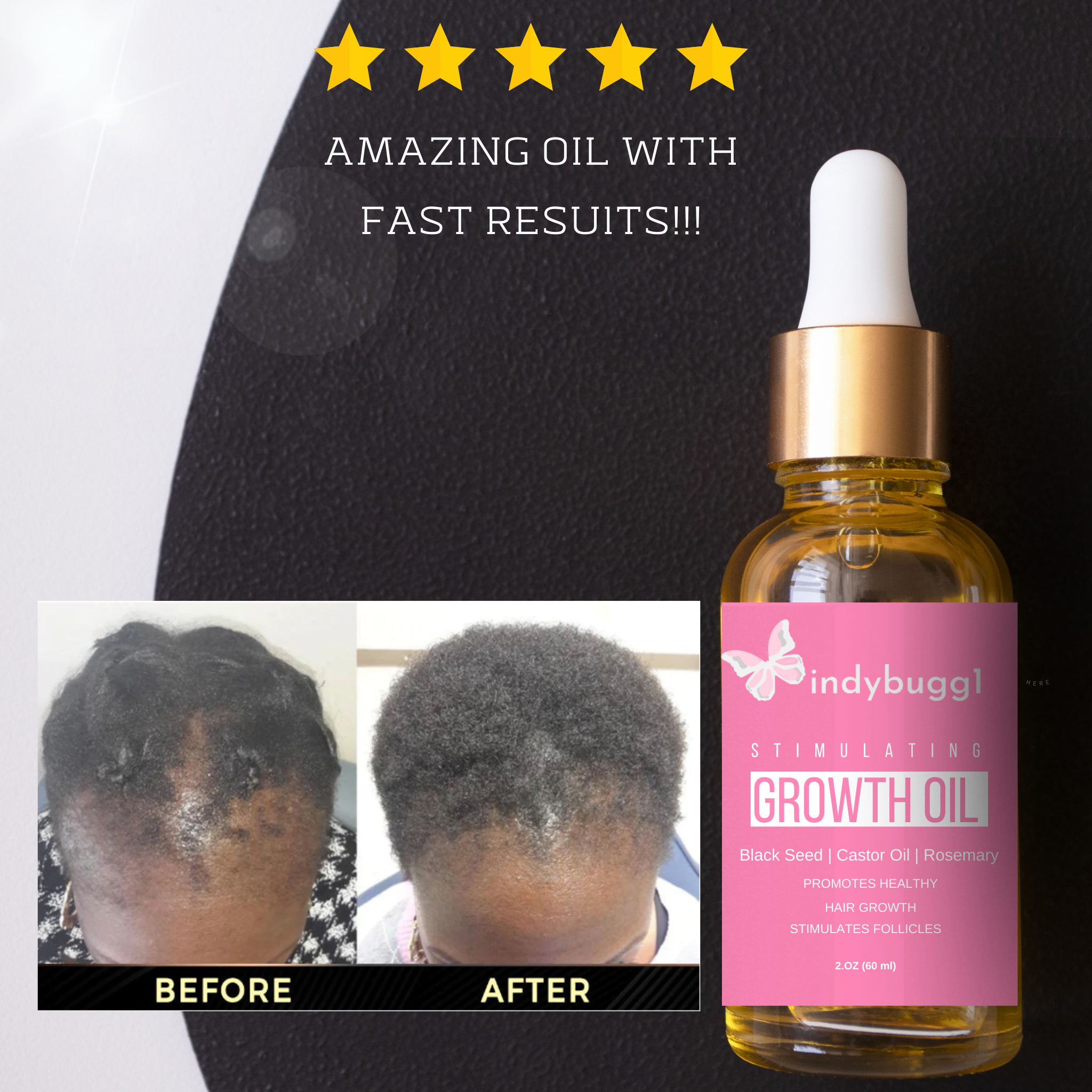INDYBUGG1 Hair Growth Oil
